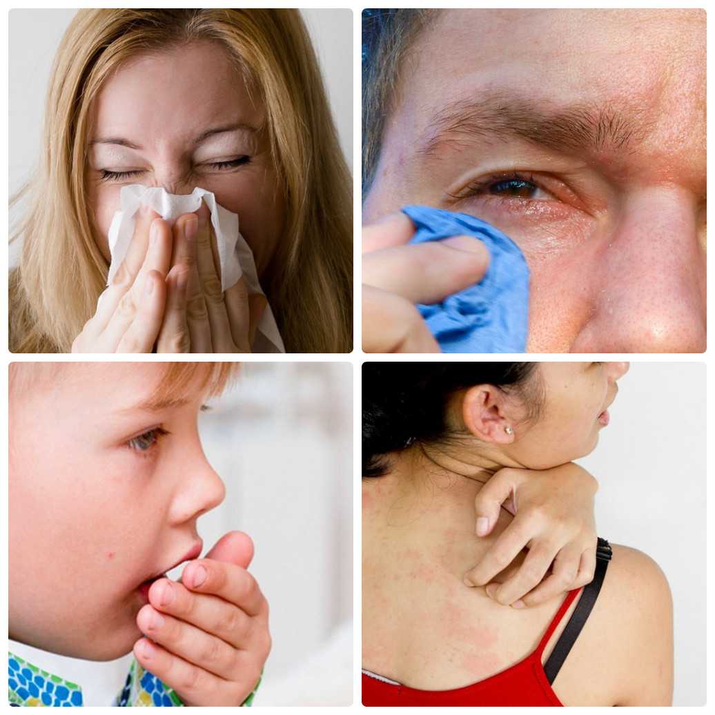 Бытовая аллергия - симптомы, причины, профилактика и лечение